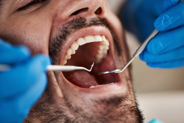 Best Pediatric Emergency Dentist in Daly City, CA