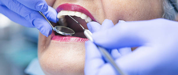 Best Mobile Emergency Dentist in Daly City, CA